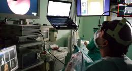 NESS – navigation endoscopic sinus surgery with virtual endoscopy (VE) as well as with virtual surgery (VS); we propose using the angles of palm position as values that represent speed of camera deflection. This approach would assure more precision while navigating VE space while also reducing working complexity
